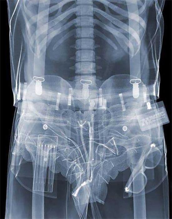 別想走私！直擊現(xiàn)在安檢機到底多厲害